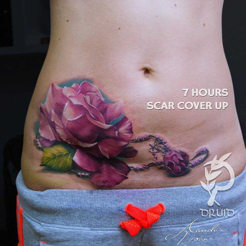 birth scar tattoo cover up